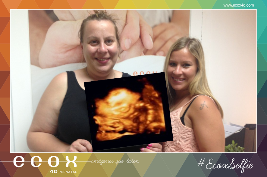 Ecografía emocional ecografía 4D de Verónica y Alicia con su hermosa bebé