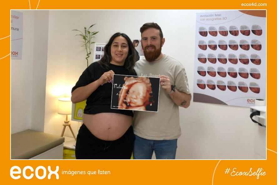 Ecografía emocional ecografía 4D de Virginia Ayelen Nuñez