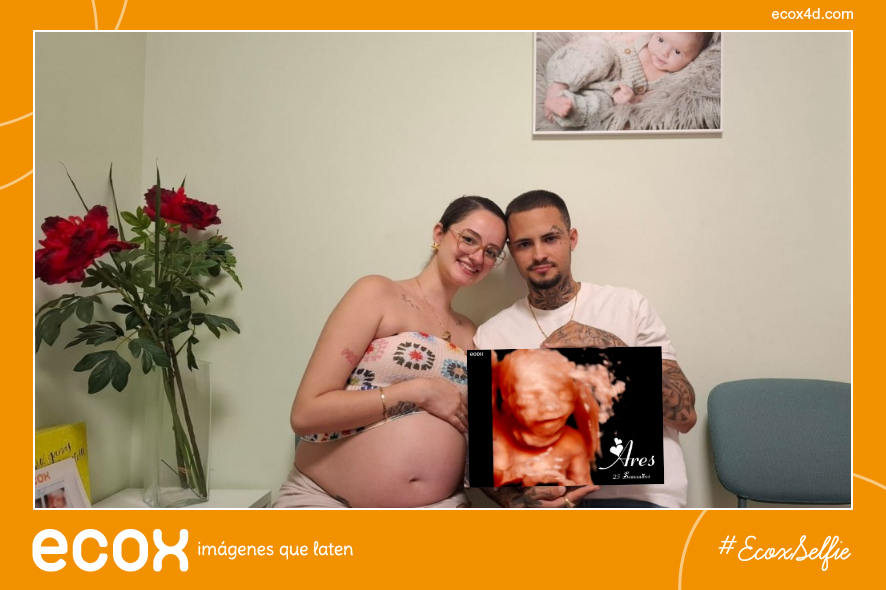 Ecografía emocional ecografía 4D de CONOCIENDO A ARES