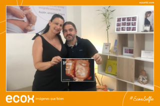 Ecografía emocional ecografía 4D de Saray Carmona Gonzalez