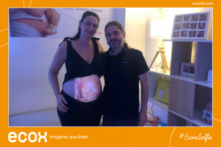 Ecografía emocional ecografía 4D de Saray Carmona Gonzalez
