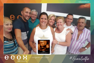 Ecografía emocional ecografía 4D de Angharad, Iván y familia