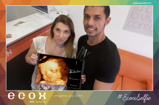 Ecografía emocional ecografía 4D de Ana María y Jorge